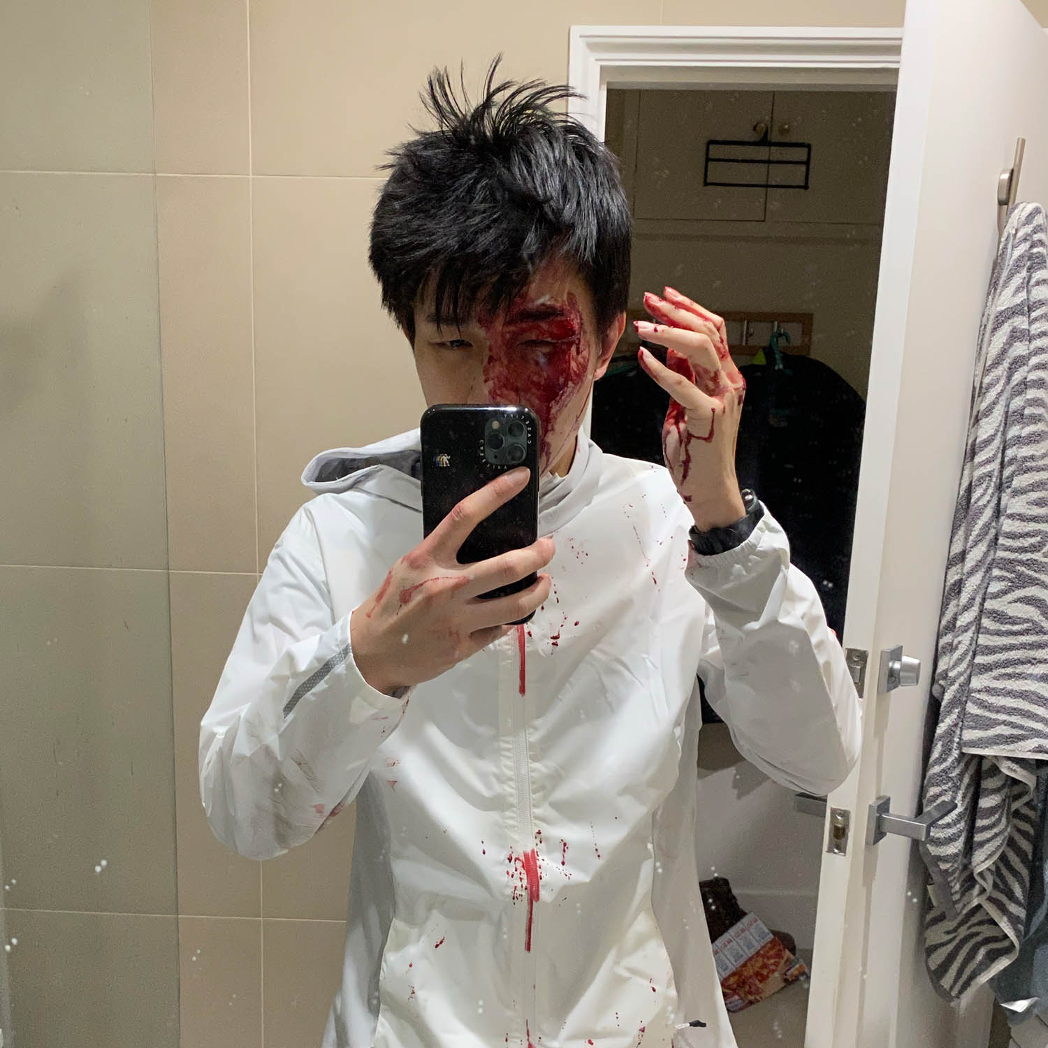 Finn Lau after being attacked in 2020