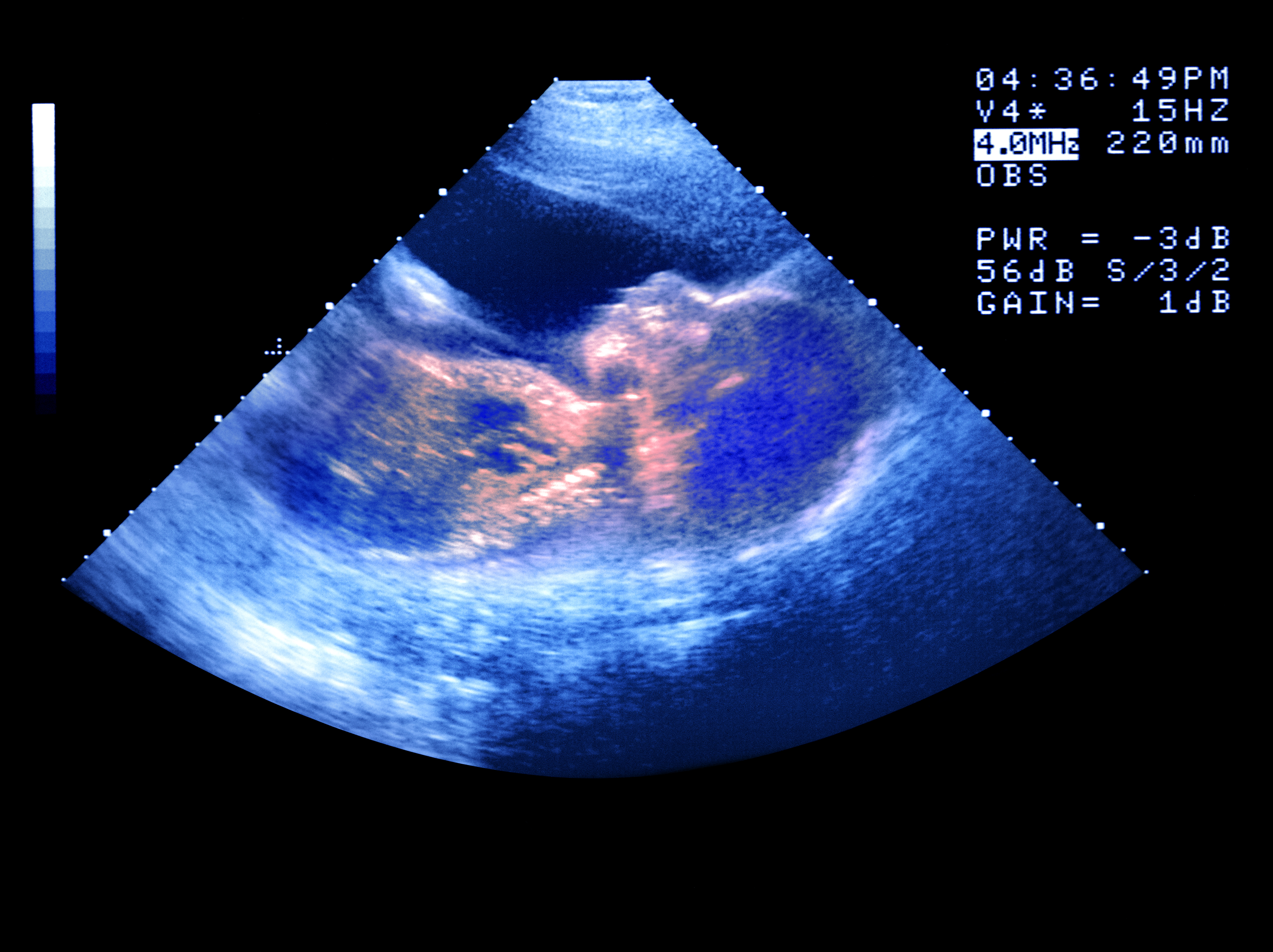 Our phones keep the score: pregnancy in the digital age
