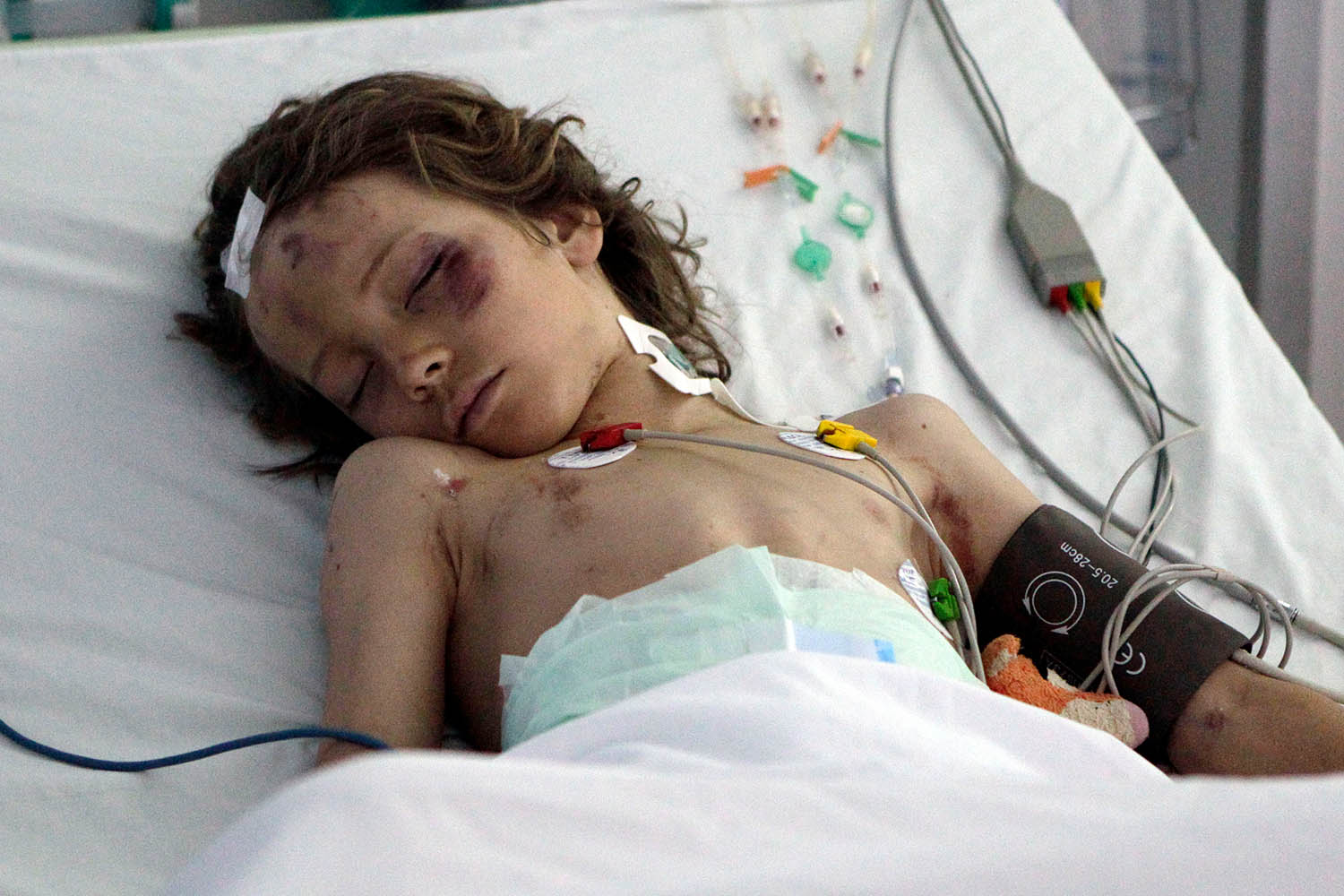Ruben van Assouw in hospital after surviving a plane crash in Libya that killed everyone else on board