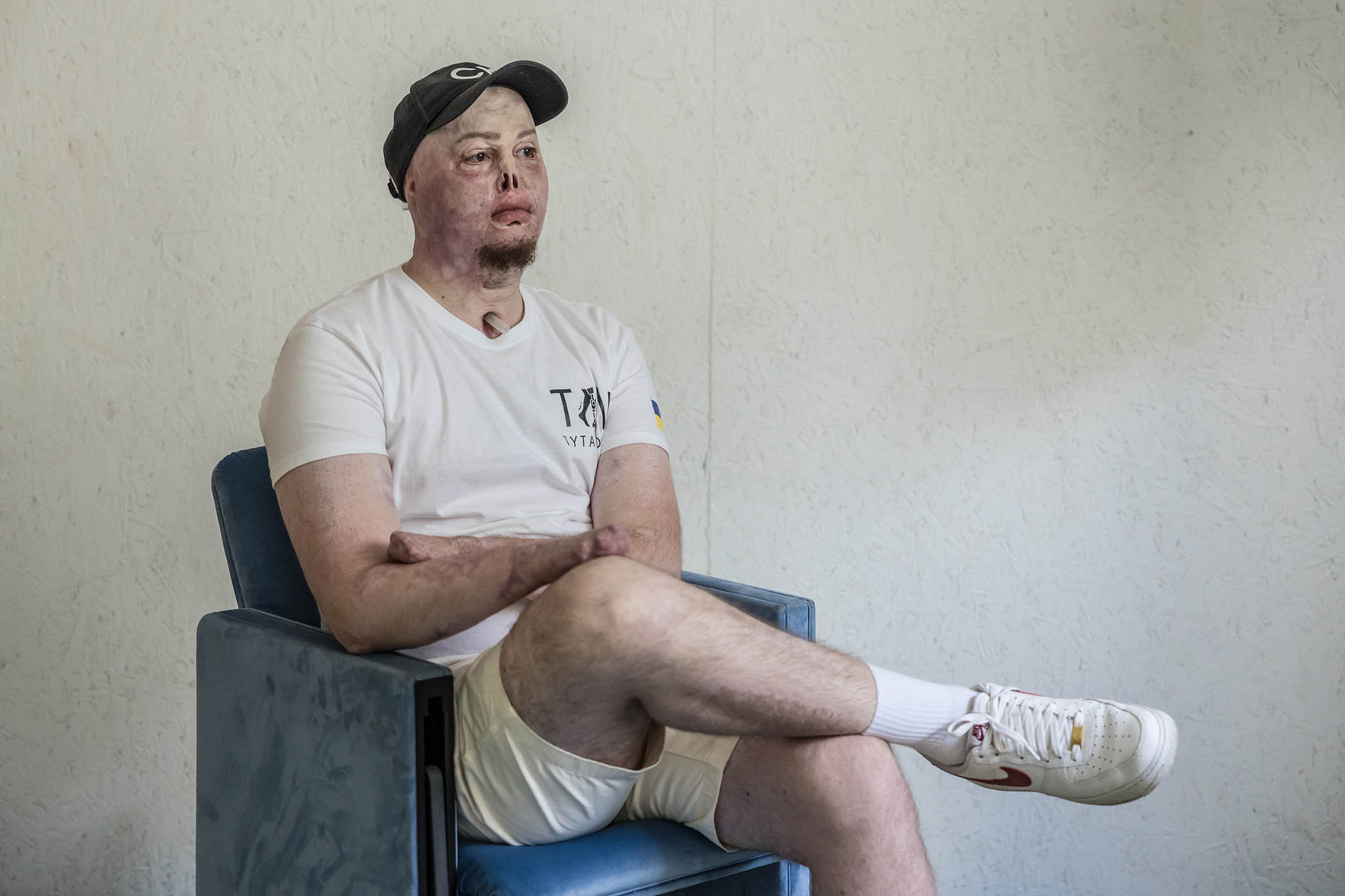 Love in a time of war: the new sex therapy for Ukraine’s injured soldiers