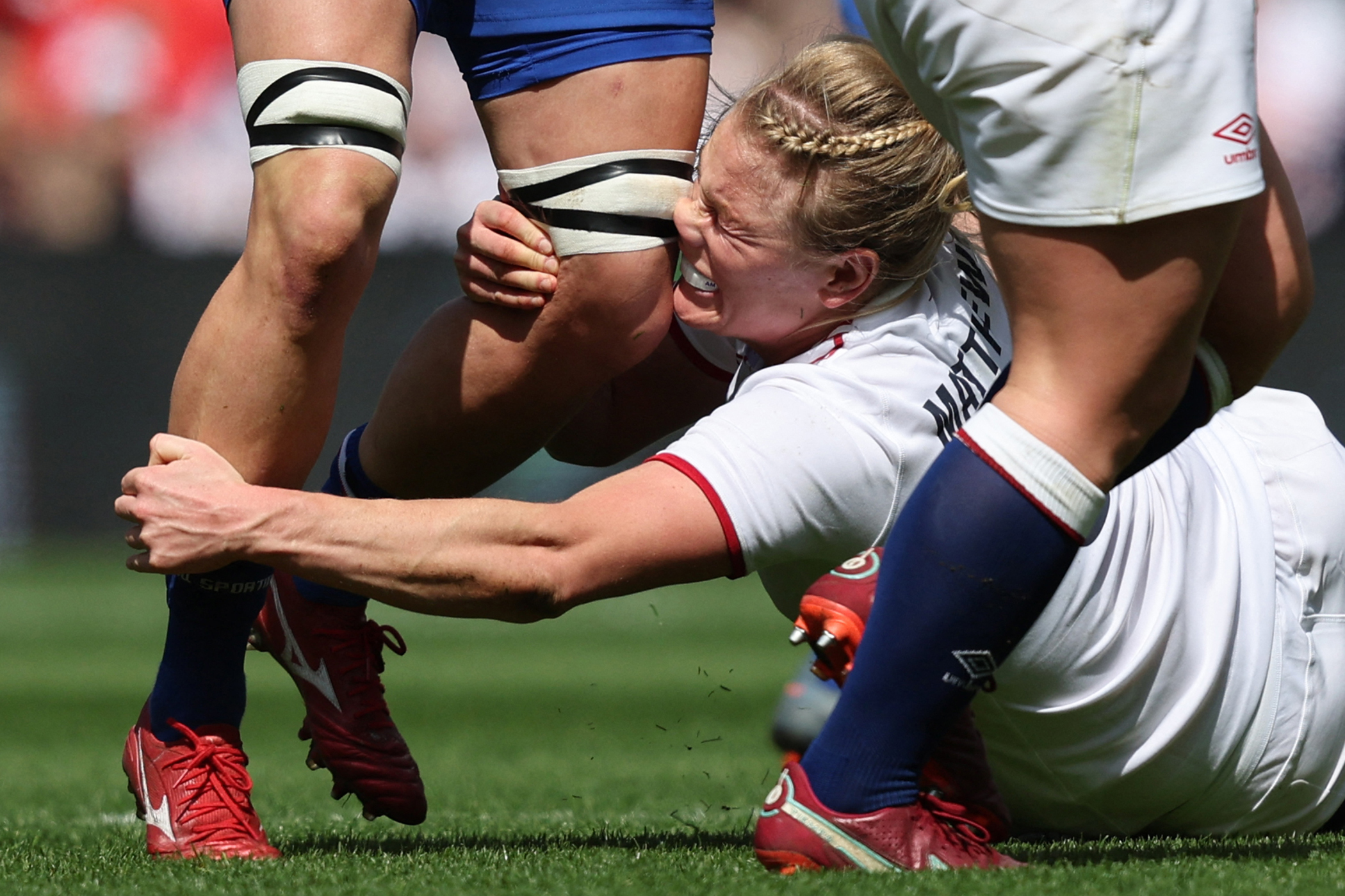 Women’s rugby: my head injury left me unable to move