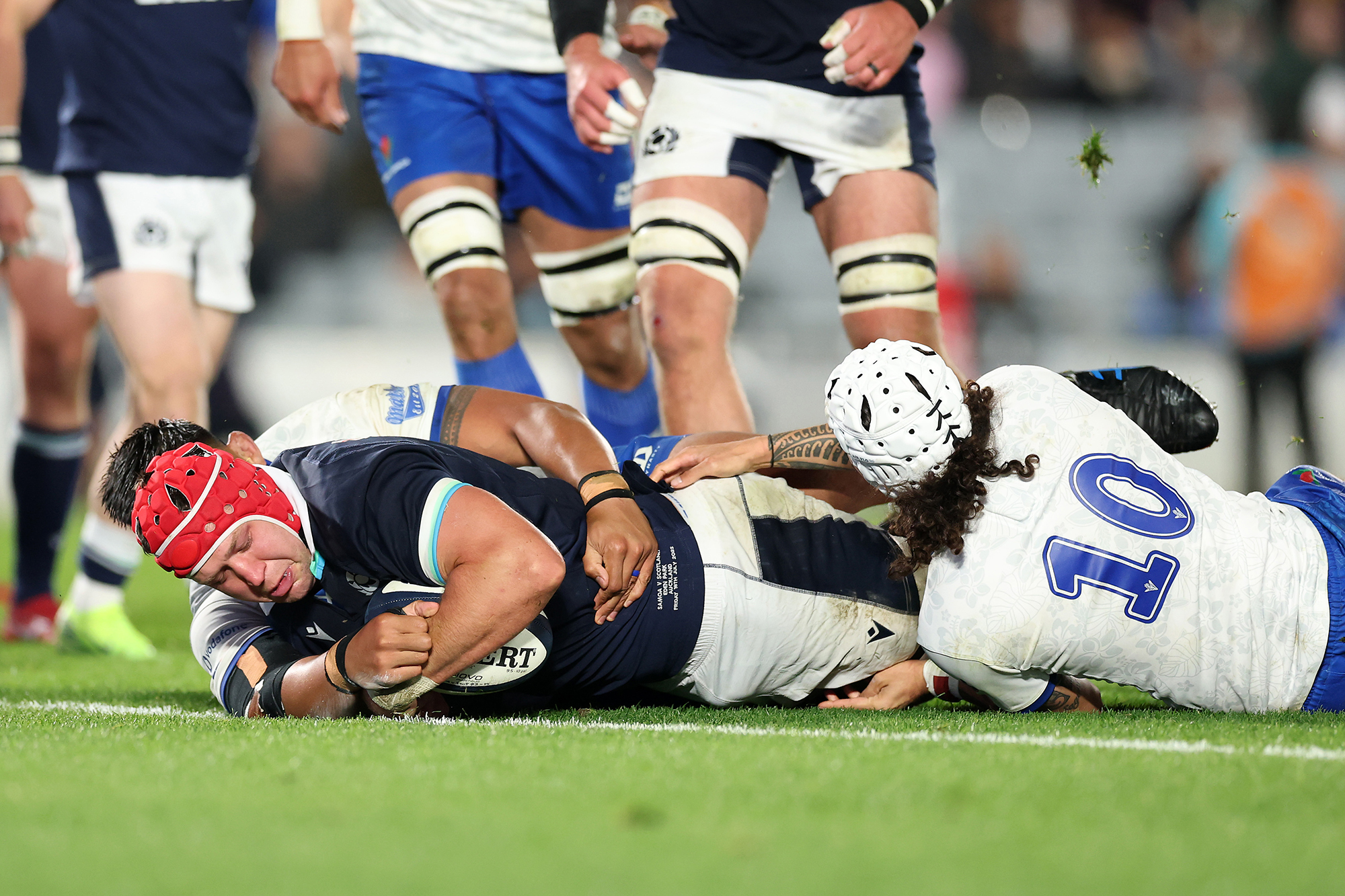 New ‘cooling cap’ that could be concussion game changer