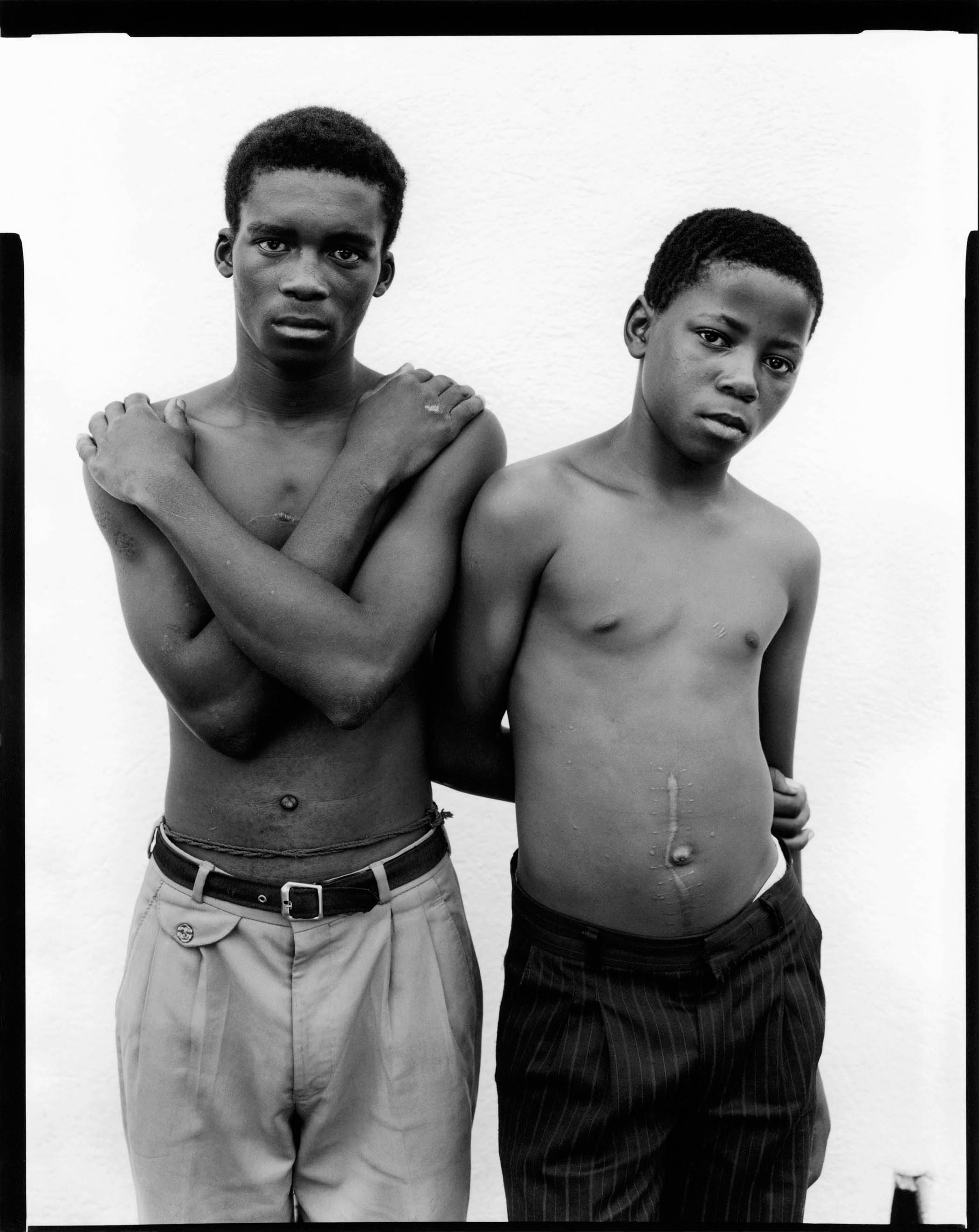 Thembinkosi Tshabe, 19, and Mxolisi Goboza, 15, described to the hearings how they had been shot and wounded by police during a demonstration